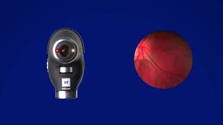 PanOptic Plus Ophthalmoscope and MacroView Plus Otoscope [upl. by Anabel]