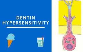 Dentin hypersensitivity Dentin Pulp Complex Session 8 [upl. by Nelly199]