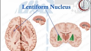 Brain Anatomy 13 Basal Ganglia 2 Lentiform NucleusInternal CapsuleClaustrum [upl. by Stevenson]