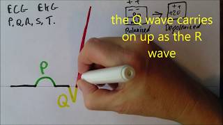 Heart 8 ECG waves [upl. by Arytal734]