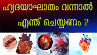 ഹൃദയഘാതം  ലക്ഷണങ്ങൾ കാരണങ്ങൾ ചികിത്സകൾ  heart attack  symptoms  treatments malayalam [upl. by Eniretac582]