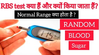 RBS Test क्या है और क्यों किया जाता है  Random Blood Sugar Test  RBS Test in Hindi [upl. by Xer]