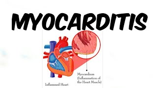 Myocarditis in Hindii [upl. by Eul]