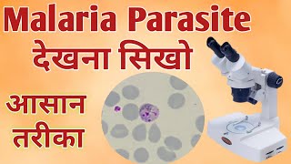 Malaria parasite under microscope  Malaria test  Malaria test procedure [upl. by Eiralam134]