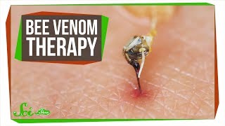 The Problem with Bee Venom Therapy [upl. by Mcnamee]