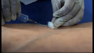 Phlebotomy venipuncture procedure Dr Sanjay D Deshmukh MD [upl. by Yddet345]