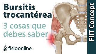 3 cosas que debes saber sobre la trocanteritis o bursitis trocantérea [upl. by Truk984]