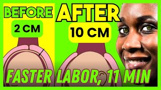 How to Dilate Cervix Faster Cervix Opening Exercise  DOCTOR V  S1E4 [upl. by Skye]