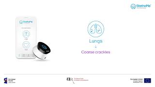 Lungs auscultation  coarse crackles 1 [upl. by Stefano]