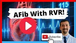 AFib with RVR Symptoms and Treatment [upl. by Aital]