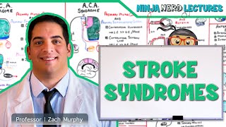 Stroke Syndromes MCA ACA ICA PCA Vertebrobasilar Artery Strokes  Pathophysiology [upl. by Argella13]