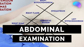 Abdominal Examination  OSCE Guide Latest  UKMLA  CPSA [upl. by Domph46]