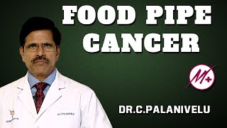 Adenocarcinoma  Food Pipe Cancer  Esophageal Cancer   DrCPalanivelu [upl. by Yesoj]