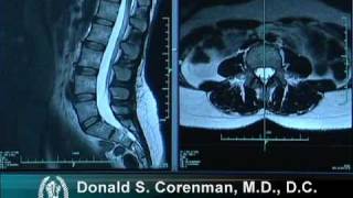 How to Read a MRI of the Normal Lumbar Spine  LowerBack  Vail Spine Specialist [upl. by Enelcaj]