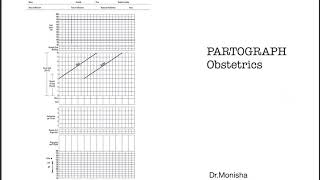 How to read a PARTOGRAPH  Obstetrics [upl. by Aubrie]