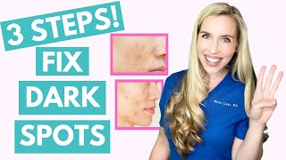 Fix Your Dark Spots in 3 Steps  Hyperpigmentation  Melasma  Skincare Made Simple [upl. by Taryne]