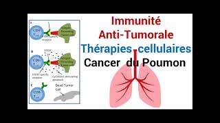 Cancer du Poumon Réponse de lImmunité AntiTumorale Thérapie cellulaire [upl. by Scheer]