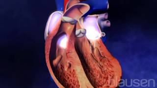 Congestive Heart Failure Animation [upl. by Ojeibbob]