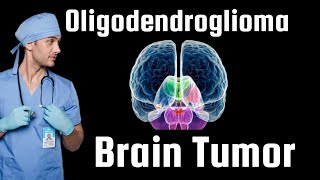 Brain Tumor  Oligodendroglioma Detailed info about diagnosis survival etc [upl. by Adnot]