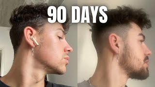 How To GROW A BEARD In 90 Days Using MINOXIDIL amp DERMA ROLLER [upl. by Seyah768]