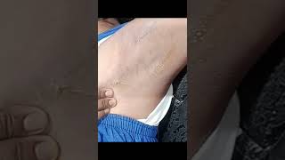 underarm waxing in hindi [upl. by Inalem]