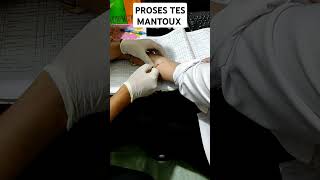 MANTOUX TEST TES MANTOUX UNTUK MENDETEKSI PENYAKIT TUBERKULOSIS [upl. by Bunow]