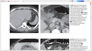 DUODENUM IMAGING DIAGNOSTIC IMAGING SERIES [upl. by Vida]