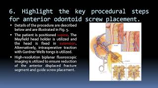 103 Type 2 Odontoid Fracture [upl. by Nosydam]