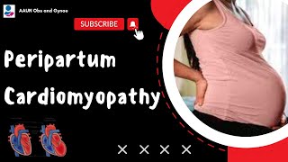 Peripartum Cardiomyopathy  TOG Article [upl. by Chisholm360]