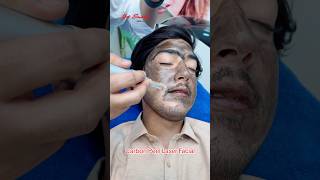 Carbon Peel Laser Facial getsmarthairclub viralvideo viralshort [upl. by Teirrah876]