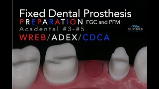 Fixed Dental Prosthesis Preparation  35 Acadental  WREBADEXCDCA [upl. by Astraea]