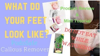 PodoSafe Callous Remover  Product Review  Mini Tutorial [upl. by Drida487]