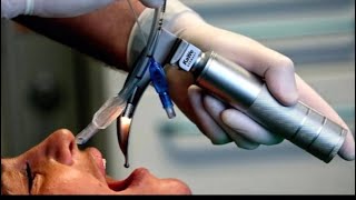 Endotracheal Tube ETT Intubation [upl. by Helsell]