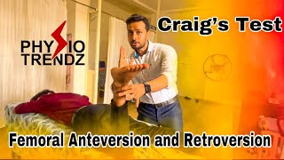 What Is Femoral Anteversion amp Retroversion and How To Test Physio trendz Physical therapy [upl. by Leban]