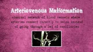 Arteriovenous Malformation [upl. by Alleuol576]