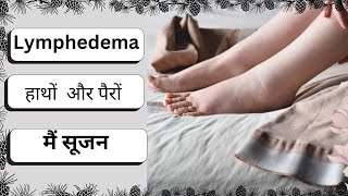 हाथों और पैरों में सूजन आने का कारण  WHY LYMPHEDEMA HAPPENS TO OUR BODY  HARIOM KUMAR [upl. by Ahsia]