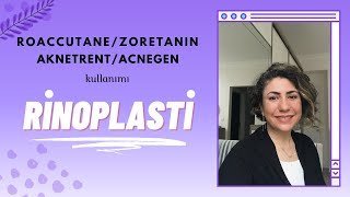 RoaccutaneZoretaninAknetrentAcnegen kullanımı ve Rinoplasti DoçDrZennure Takcı Anlatıyor [upl. by Ecela253]