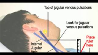 JUGULAR VENOUS PRESSURE  MEDICINE LECTURES  Cardiology Lectures [upl. by Riada]