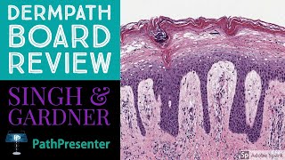 Dermpath Board Review 100 Classic Cases [upl. by Checani686]