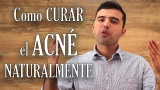 Como Curar el Acne Naturalmente [upl. by Zulch]