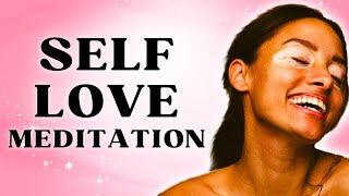 10 Minute Meditation for UNCONDITIONAL Self Love 💞 [upl. by Huei]