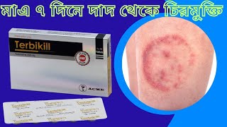 দাদ হলে কি করবেন  দাদের চিকিৎসা  Terbikil 250  Dermomix Cream  Fungal infection  Ringwarm [upl. by Peednam972]