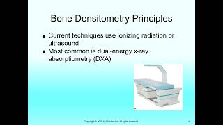 Bone Densitometry [upl. by Reema]