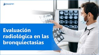 Evaluación radiológica en las bronquiectasias  Radiografía  Tomografía Computarizada [upl. by Noteek]