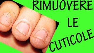 COME RIMUOVERE LE CUTICOLE Sos unghie 9 [upl. by Uno]