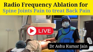 RFA radio frequency ablation for Spine Joints Pain to treat Back Pain [upl. by Ettennil]