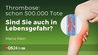 Thrombose – Prophylaxe und Behandlung  Kleinsche Felder  Marco Klein  QS24 Gesundheitsfernsehen [upl. by Ramyar795]