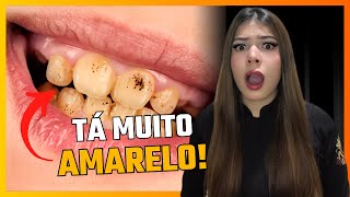 3 Dicas Para Evitar DENTES AMARELOS [upl. by Ynnahc]