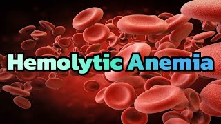 Hemolytic Anemia updated 2023  CRASH Medical Review Series [upl. by Kirsteni]