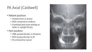 Radiographic Positioning of the Facial Bones [upl. by Winograd]